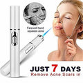 Blue light therapy pen for acne treatment and skin rejuvenation, handheld device with blue LED light for facial skin care.