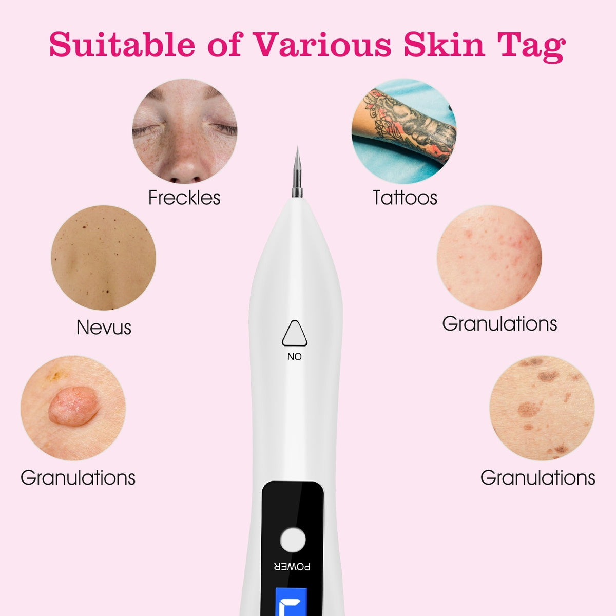 Professional Skin Tag Remover Kit - LCD Display with 6 Replaceable Tip ...